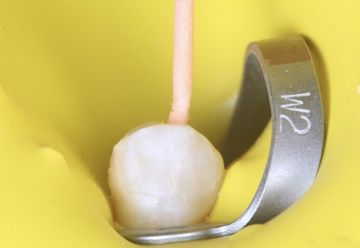 dentalmed.-endodontia (1)