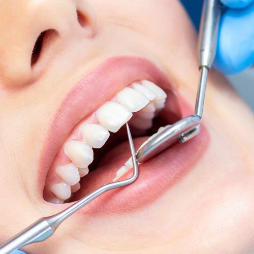 mulher-no-dentista-para-exame-de-dentes_170532-1664